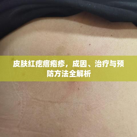 皮肤红疙瘩疱疹，成因、治疗与预防方法全解析